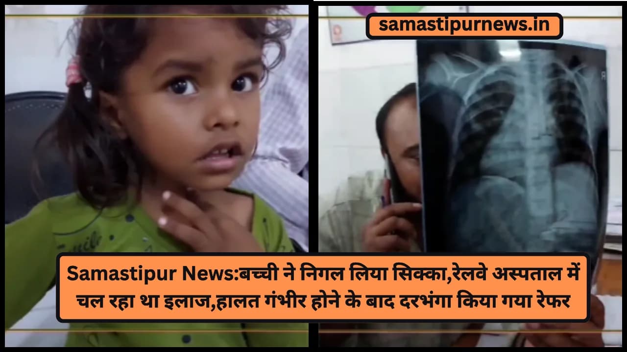 Samastipur News:बच्ची ने निगल लिया सिक्का,रेलवे अस्पताल में चल रहा था इलाज,हालत गंभीर होने के बाद दरभंगा किया गया रेफर