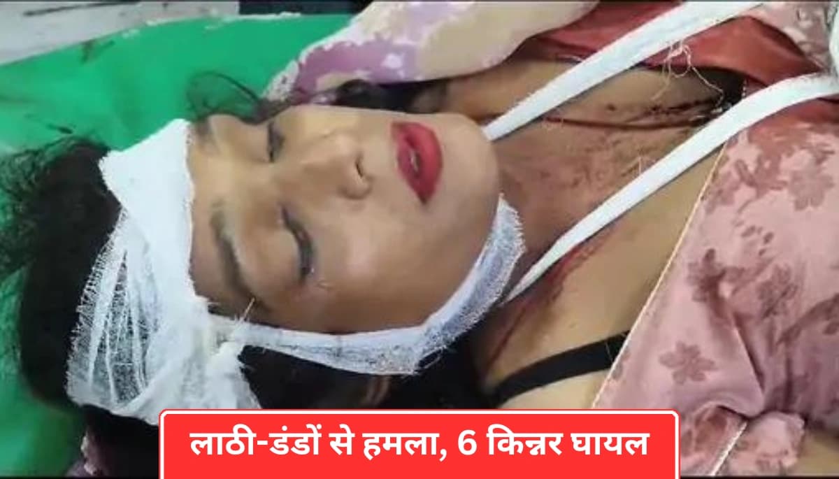 समस्तीपुर, बिहार: दीवाली की बख्शीश को लेकर किन्नरों के गुटों में झड़प, 6 घायल, पुलिस जांच में जुटी