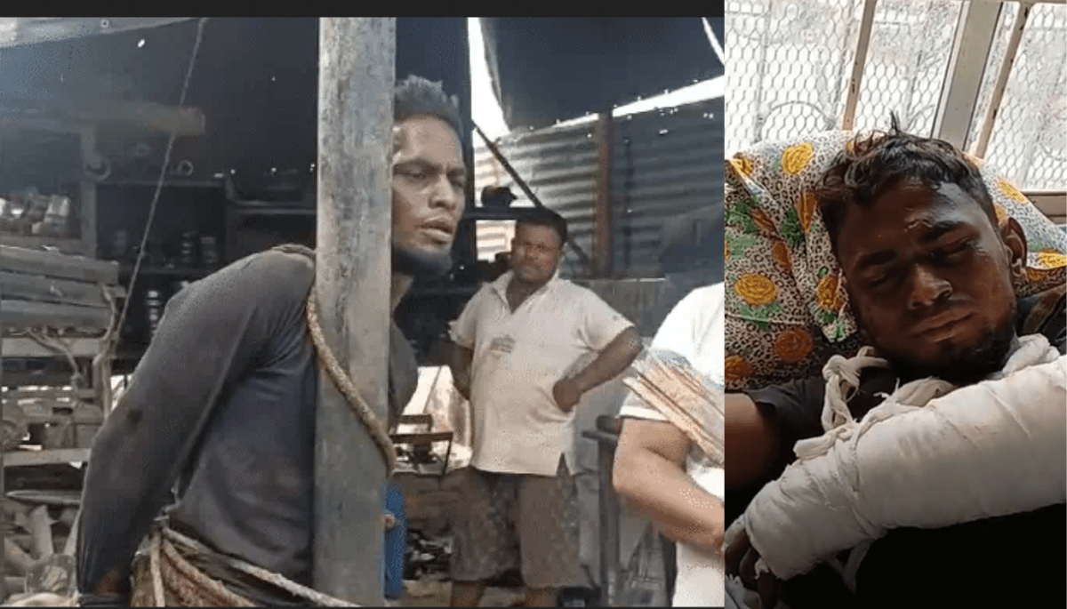 मुजफ्फरपुर में मजदूर के साथ बर्बरता: कबाड़ दुकानदार ने चोरी का आरोप लगाकर खंभे से बांधकर की पिटाई, हाथ-पैर तोड़े, प्राइवेट पार्ट में डंडा डाला