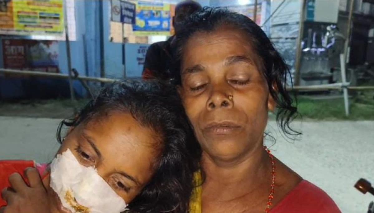 अजब गजब! 15 रुपये बकाया नहीं चुकाने पर दुकानदार ने की महिला पर हमला, नाक काटी; जानिए पूरी घटना