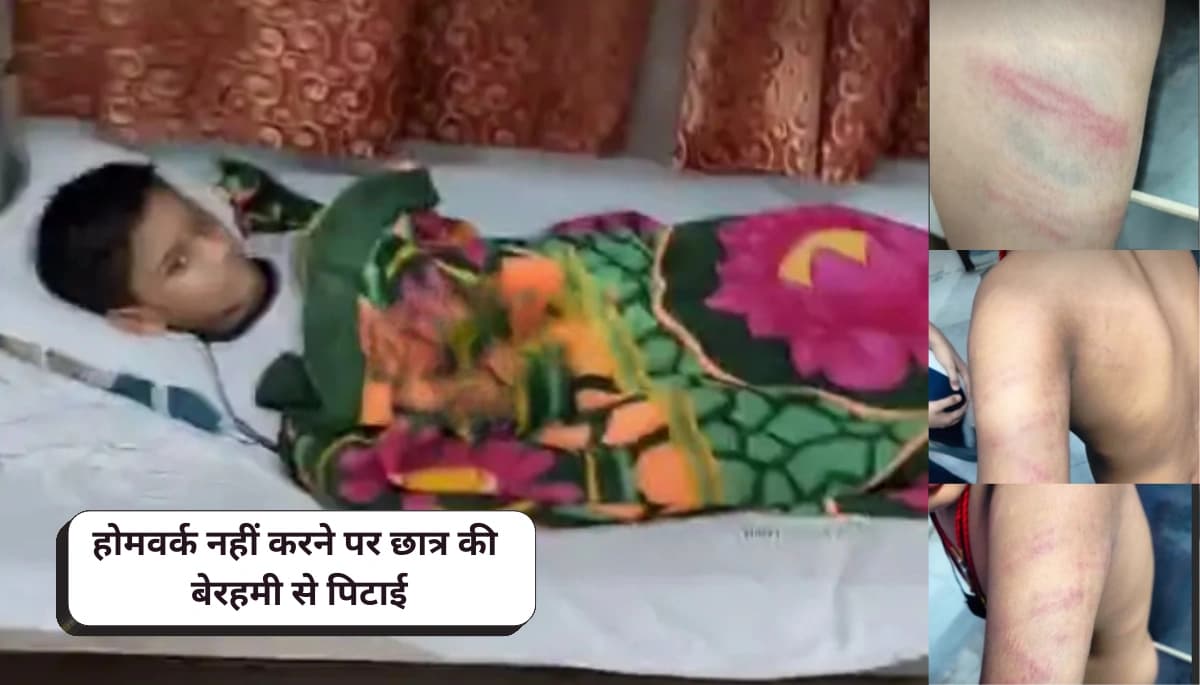 School teacher brutally beats student in Muzaffarpur: पुलिस में मामला दर्ज, परिजन स्कूल पहुंचे