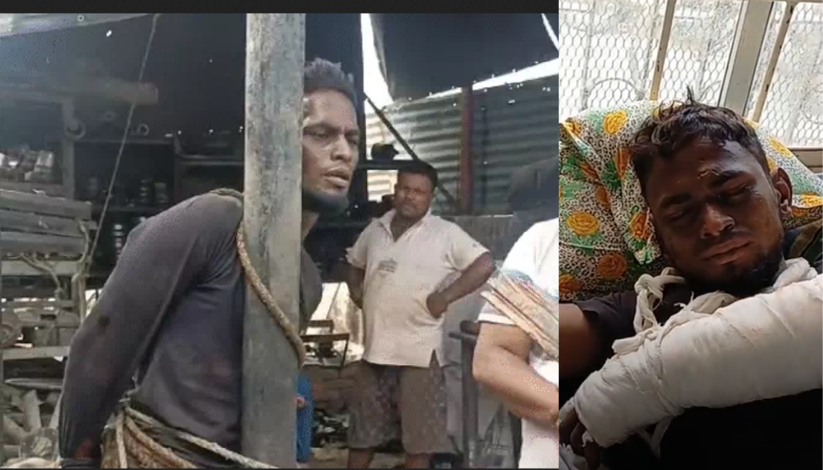 मुजफ्फरपुर में मजदूर के साथ बर्बरता: कबाड़ दुकानदार ने चोरी का आरोप लगाकर खंभे से बांधकर की पिटाई, हाथ-पैर तोड़े, प्राइवेट पार्ट में डंडा डाला 1 मुजफ्फरपुर में मजदूर के साथ बर्बरता: कबाड़ दुकानदार ने चोरी का आरोप लगाकर खंभे से बांधकर की पिटाई, हाथ-पैर तोड़े, प्राइवेट पार्ट में डंडा डाला