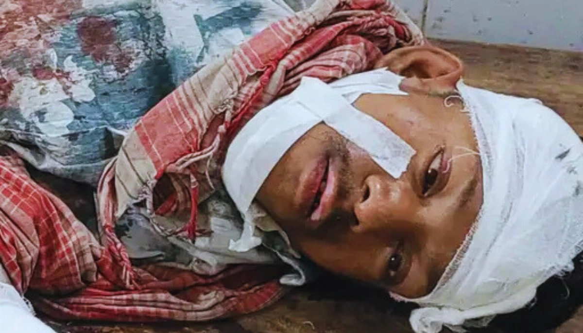 दरभंगा रेलवे स्टेशन पर ट्रेन से गिरा युवक, डीएमसीएच में भर्ती! जानें कैसे हुआ ये दर्दनाक हादसा 1 दरभंगा रेलवे स्टेशन पर ट्रेन से गिरा युवक, डीएमसीएच में भर्ती! जानें कैसे हुआ ये दर्दनाक हादसा