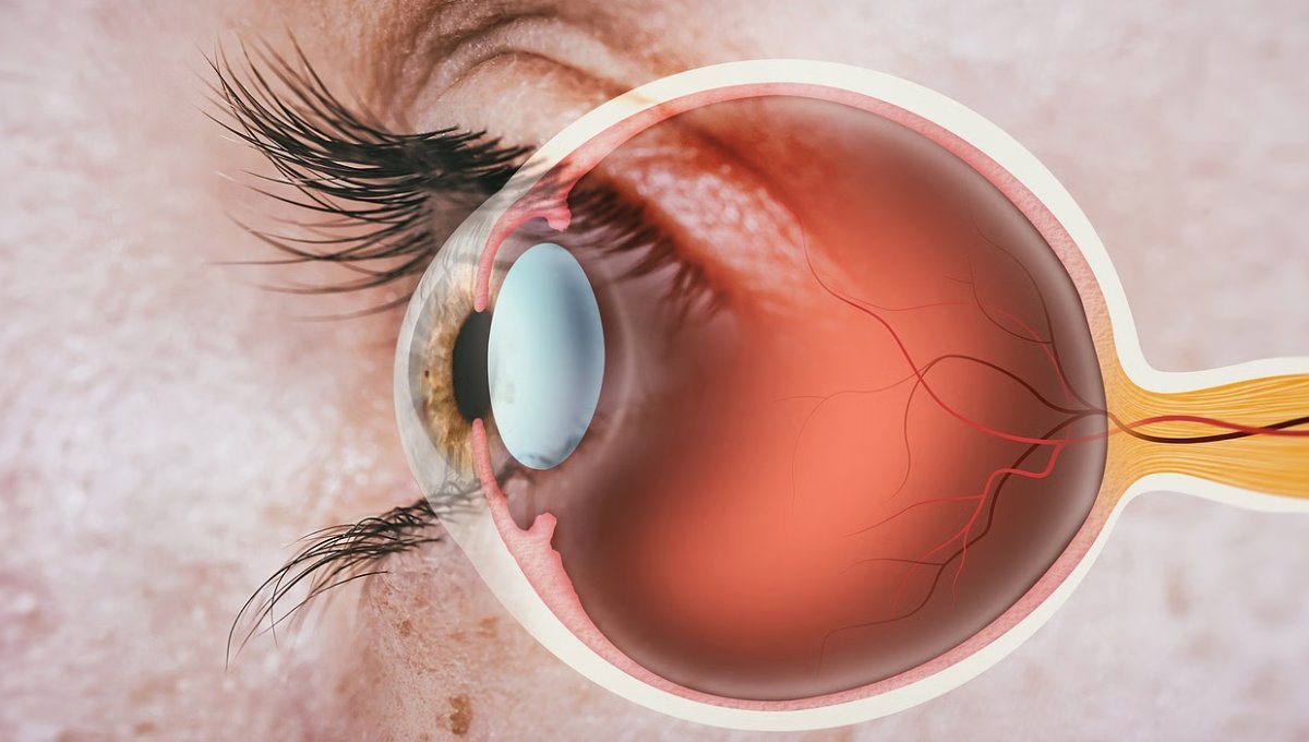 गर्मियों में Eye Health पर मंडराता खतरा: अब करें पूरी देखभाल 2 गर्मियों में Eye Health पर मंडराता खतरा: अब करें पूरी देखभाल