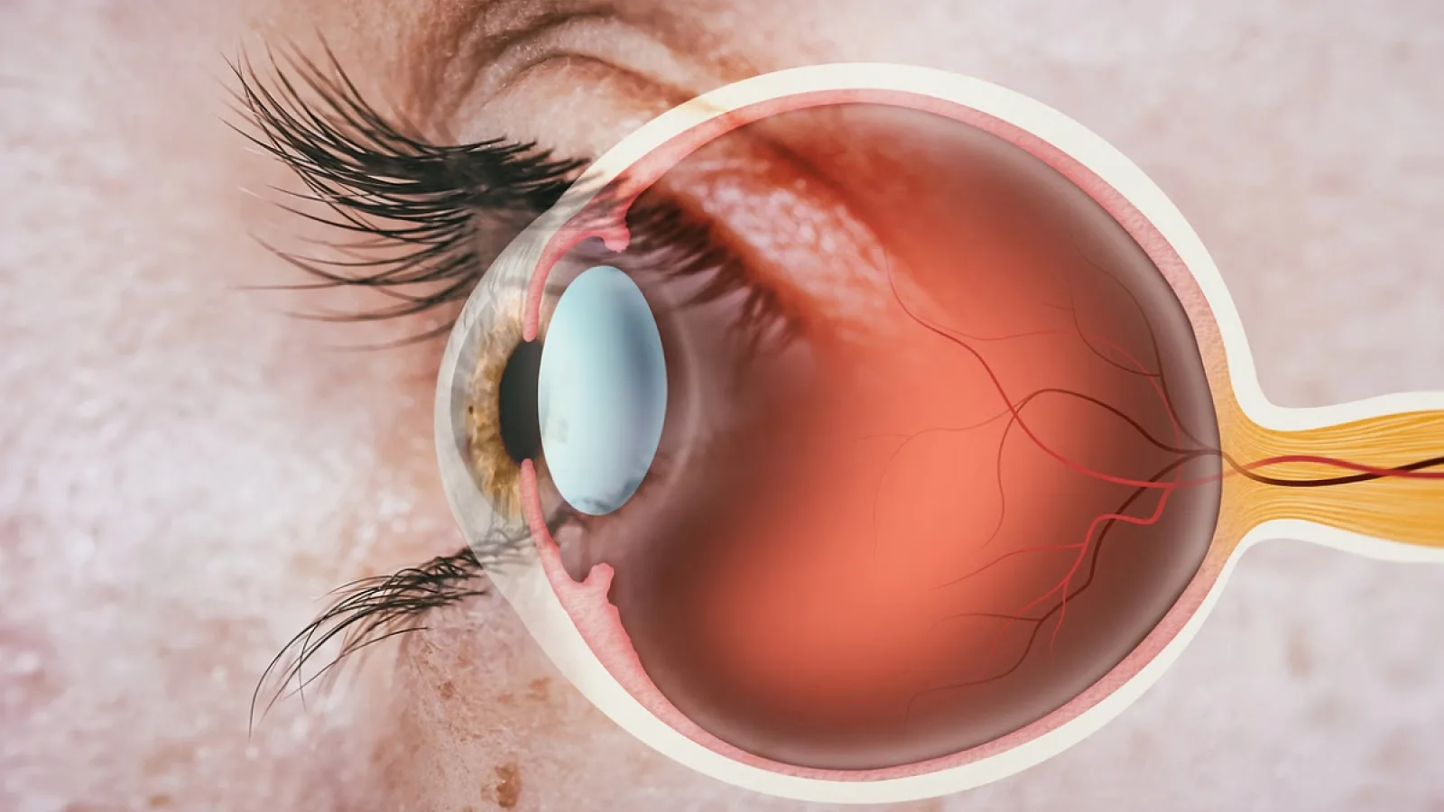 गर्मियों में Eye Health पर मंडराता खतरा: अब करें पूरी देखभाल